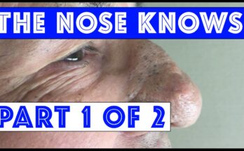 The Nose Knows: Part I "Mr. Wilson's" Blackhead Extractions